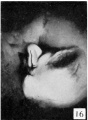 Fig. 16. Carnegie Embryo No. 1900-60b Male