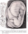 Frazer embryo 10mm CRL