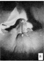 Fig. 8. Carnegie Embryo 955 Male