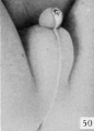 Fig. 50. No. 834, 98 mm., male. X 3.