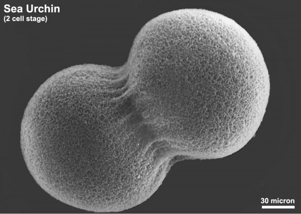 Sea Urchin Development - Embryology