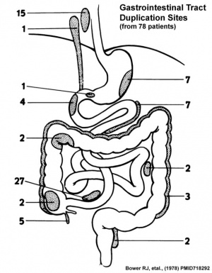 Gastrointestinal tract duplication sites based upon 78 clinical studies.[2]