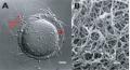 Mouse oocyte and zona pellucida - light and TEM