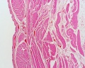 Low power image showing underlying muscle layers.