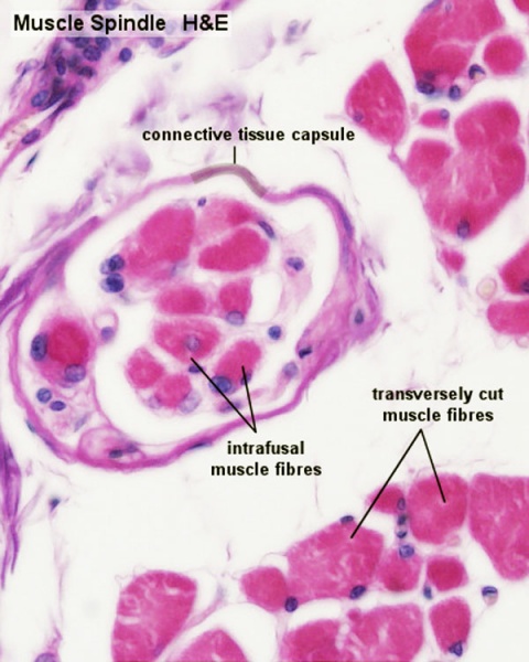 File:Skeletal muscle histology 015.jpg