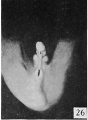 Fig. 26. No. 217, 45 mm., male. X 4.