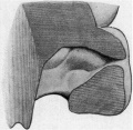 Fig 8. Medial wall of nose