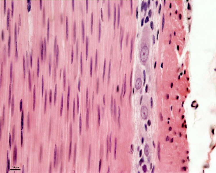 File:Smooth muscle histology 003.jpg