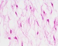 Placenta histology 003.jpg