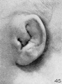Fig. 45. Embryo No. 981, 85 mm.