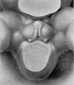 Fig. 3. Carnegie Embryo No. 2702, 8 mm X 18.5