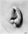 Fig. 27. Embryo No. 1358b, 33.2 mm long. X 24.