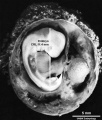 Embryo CRL