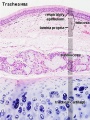 Trachea (detail layers)