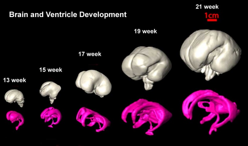 File:Brain ventricles and ganglia development 03.jpg