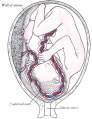 Fetus in Utero Between fifth and sixth months