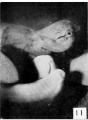 Fig. 11. Carnegie Embryo No. 2023