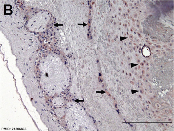 Human placenta SERPINE2 expression 01.jpg