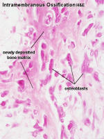 intramembranous ossification