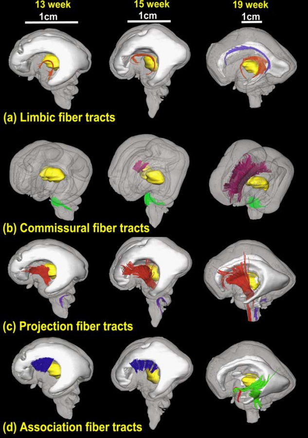File:Brain tract development 01.jpg - Embryology