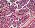 Pancreas histology 101.jpg