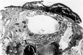 Fig. 5. Blastocyst entirely surrounded by short villi