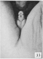 Fig. 33. Carnegie 1474b, 58 mm Male