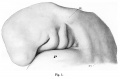 Fig. 1. Embryo 4-9 mm
