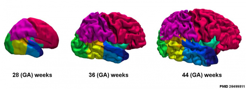 Fetal brain MRI01.jpg