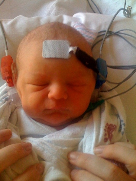 File:Infant hearing test.jpg