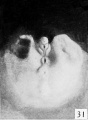 Fig. 31. Carnegie 1686 46 mm Male