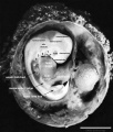 Embryo features