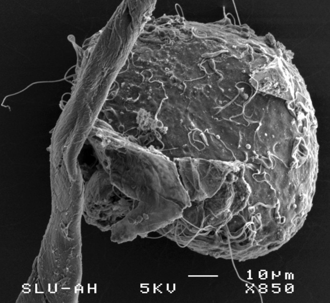 File:Cat spermatozoa bound to oocyte zona pellucida.jpg