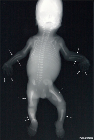 X-ray - Embryology