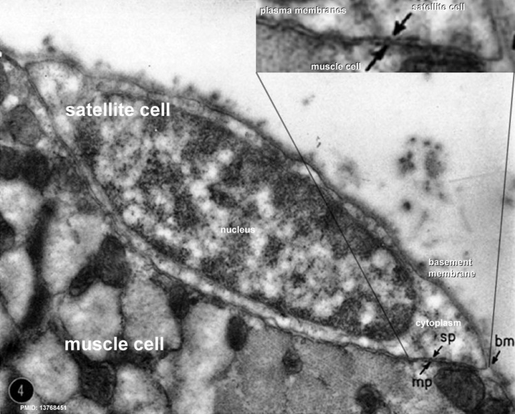 File:Muscle satellite cell EM02.jpg