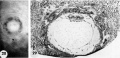 28-29 surface and mid-cross section view 12-day ovum