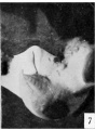 Fig. 7. Carnegie Embryo No. 1936 Male