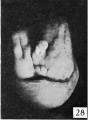 Fig. 28. No. 607, 38 mm., male. X 4.