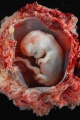 Embryo and placenta