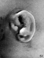 Fig. 51. Embryo No. 2185, 113.5 mm. Fig. 56. No. 1782, 135.6 mm.