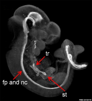 Mouse embryo E11 HNF3beta notochord marker 02.jpg