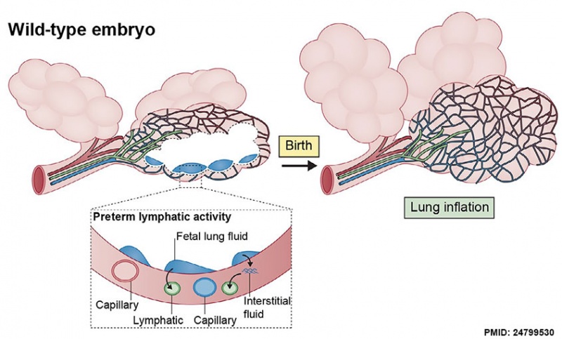 File:Birth lymphatics lung inflation cartoon.jpg