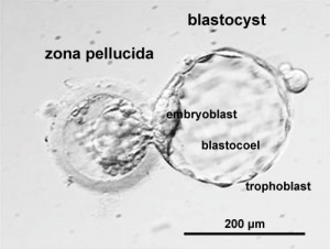 Hatching Blastocyst