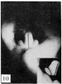 Fig. 10. Carnegie Embryo No. 389a Male