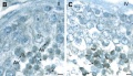 Human spermatozoa - phospholipase C zeta localization[40]