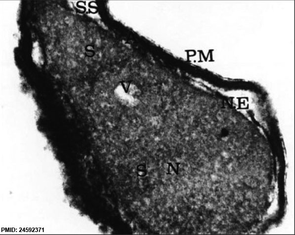 File:Human spermatozoa nucleus EM02.jpg