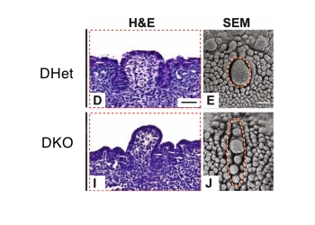 CVP of WT(top) and DKO(bottom) mice with H&E and SEM.png