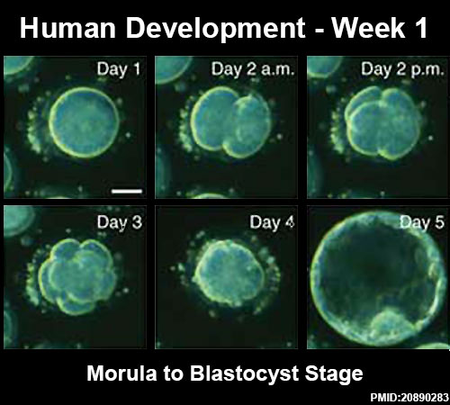 File:Human blastocyst day 1-5.jpg