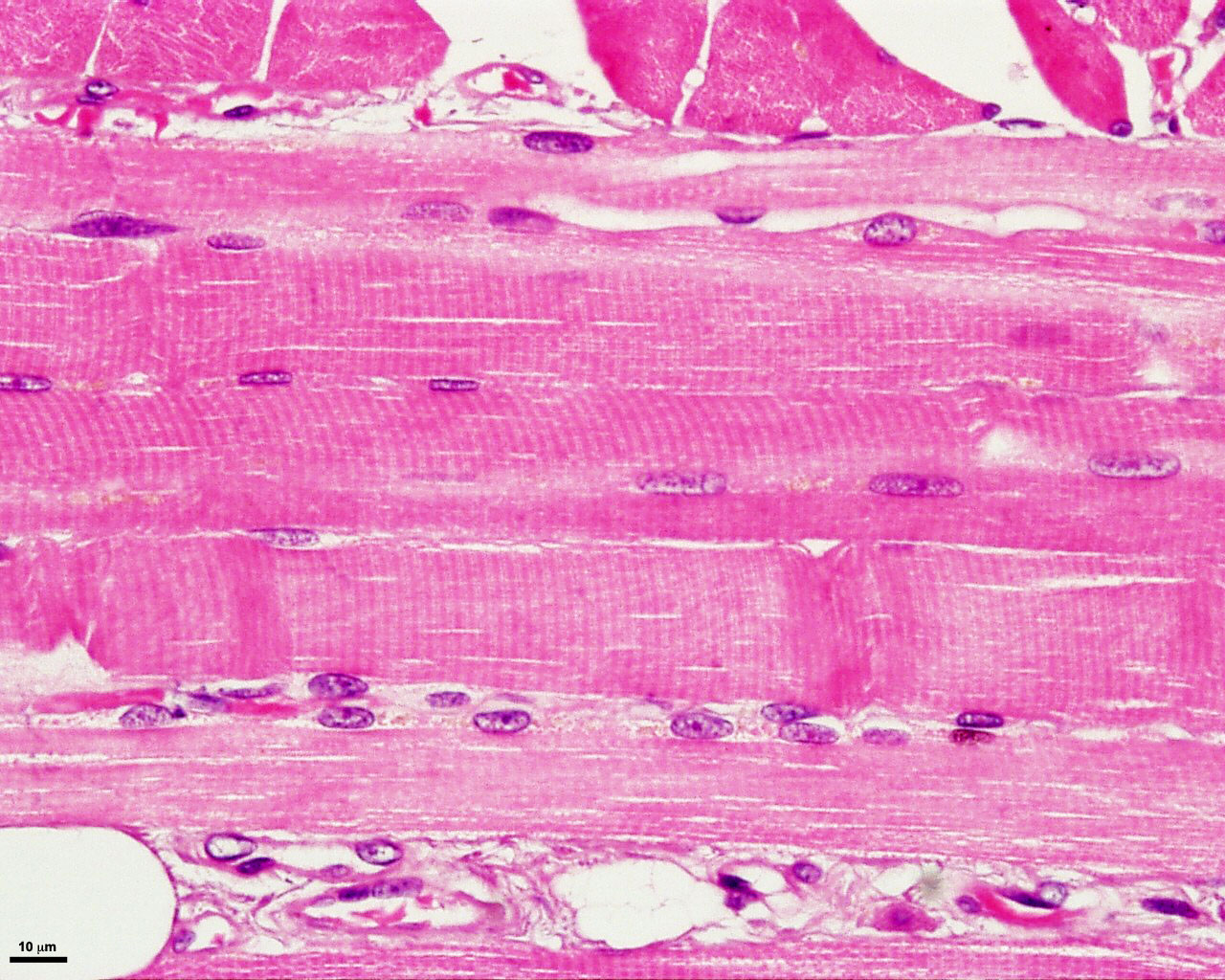 Skeletal Muscle Tissue Under Microscope Labeled - Micropedia
