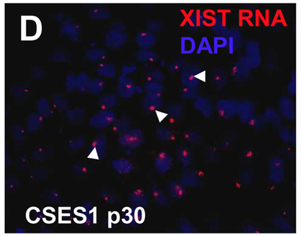 File:XIST human embryonic stem cells 02.jpg